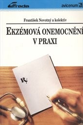 Ekzémová onemocnění v praxi