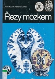 Řezy mozkem