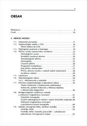 Hnisav&eacute; z&aacute;něty mozku