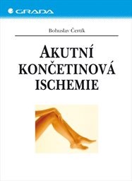 Akutní končetinová ischemie