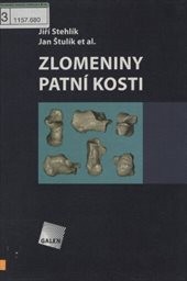 Zlomeniny patní kosti