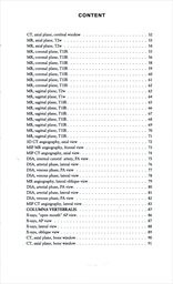 Anatomia neuro radiologica basalis