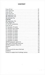 Anatomia neuro radiologica basalis