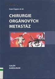 Chirurgie org&aacute;nov&yacute;ch metast&aacute;z
