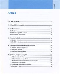Crohnova nemoc a ulcerózní kolitida