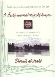 Úskalí diagnostiky a endovaskulární terapie onemocnění mozkových tepen, zobrazování hlavy a krku