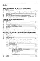 Trendy soudob&eacute; oftalmologie