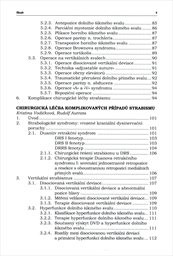 Trendy soudob&eacute; oftalmologie