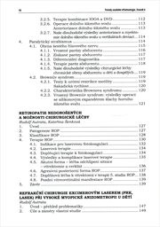 Trendy soudob&eacute; oftalmologie