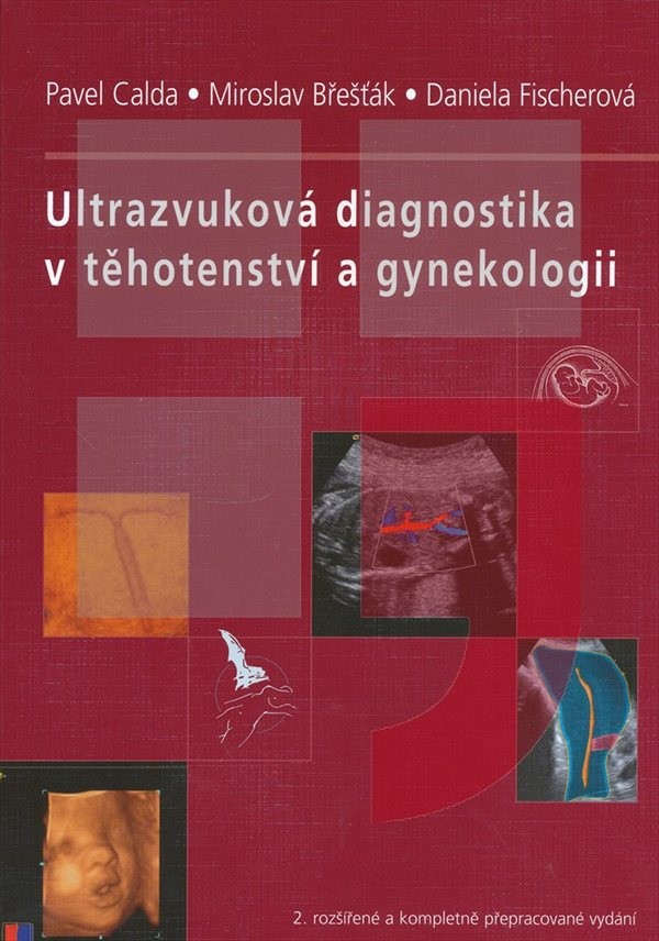 co je první druhá třetí základna v randění