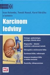 Karcinom ledviny
