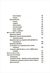 Fenomén hypnóza