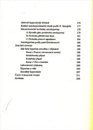Fenomén hypnóza