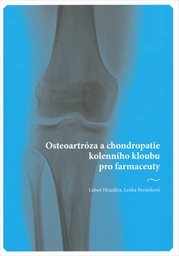 Osteoartróza a chondropatie kolenního kloubu pro farmaceuty