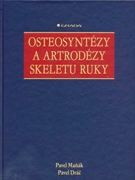 Osteosyntézy a artrodézy skeletu ruky