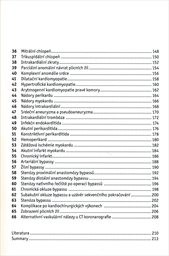 Multidetektorov&aacute; v&yacute;početn&iacute; tomografie srdce