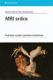 MRI srdce