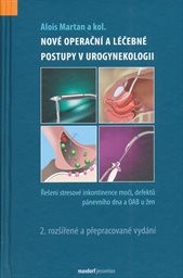 Nové operační a léčebné postupy v urogynekologii