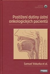 Postižen&iacute; dutiny &uacute;stn&iacute; onkologick&yacute;ch pacientů
