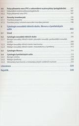 Kapesn&iacute; atlas hematologie