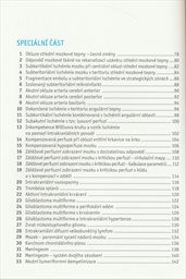 Multidetektorov&aacute; v&yacute;početn&iacute; tomografie