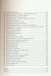 Multidetektorov&aacute; v&yacute;početn&iacute; tomografie