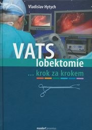 VATS lobektomie krok za krokem