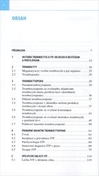 Imunitn&iacute; trombocytopenie