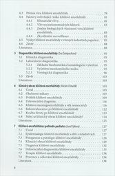 Kl&iacute;šťov&aacute; encefalitida