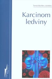 Karcinom ledviny