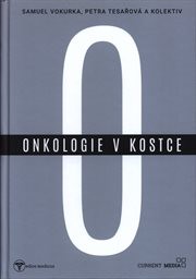 Onkologie v kostce