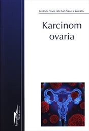Karcinom ovaria