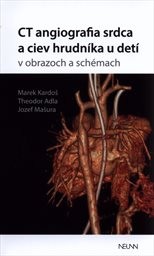 CT angiografia srdca a ciev hrudníka u detí v obrazoch a schémach